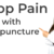 Acupuncture Tips That Will Help You Improve Your Health