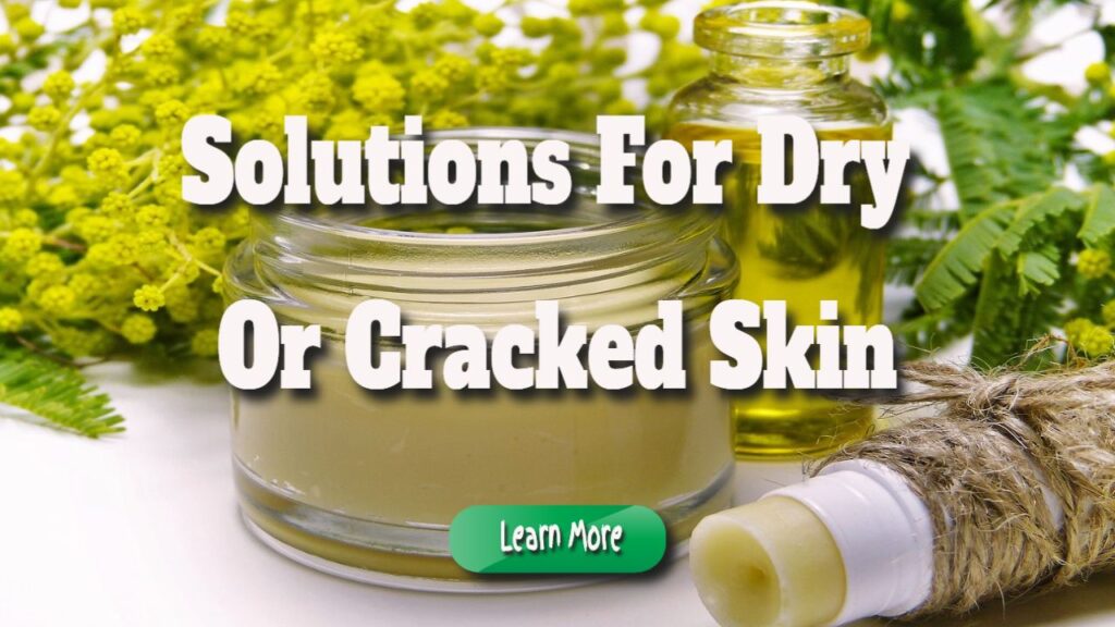 solutions for dry or cracked skin