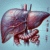 Comprehensive Liver Blood Test Services in Tewkesbury