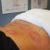 Sports Recovery Acupuncture: Explore 6 Essential Benefits